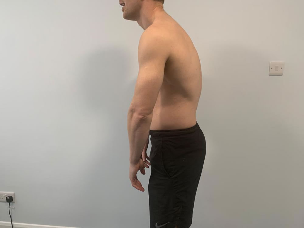 Hip Pain - Recover Physio Hastings